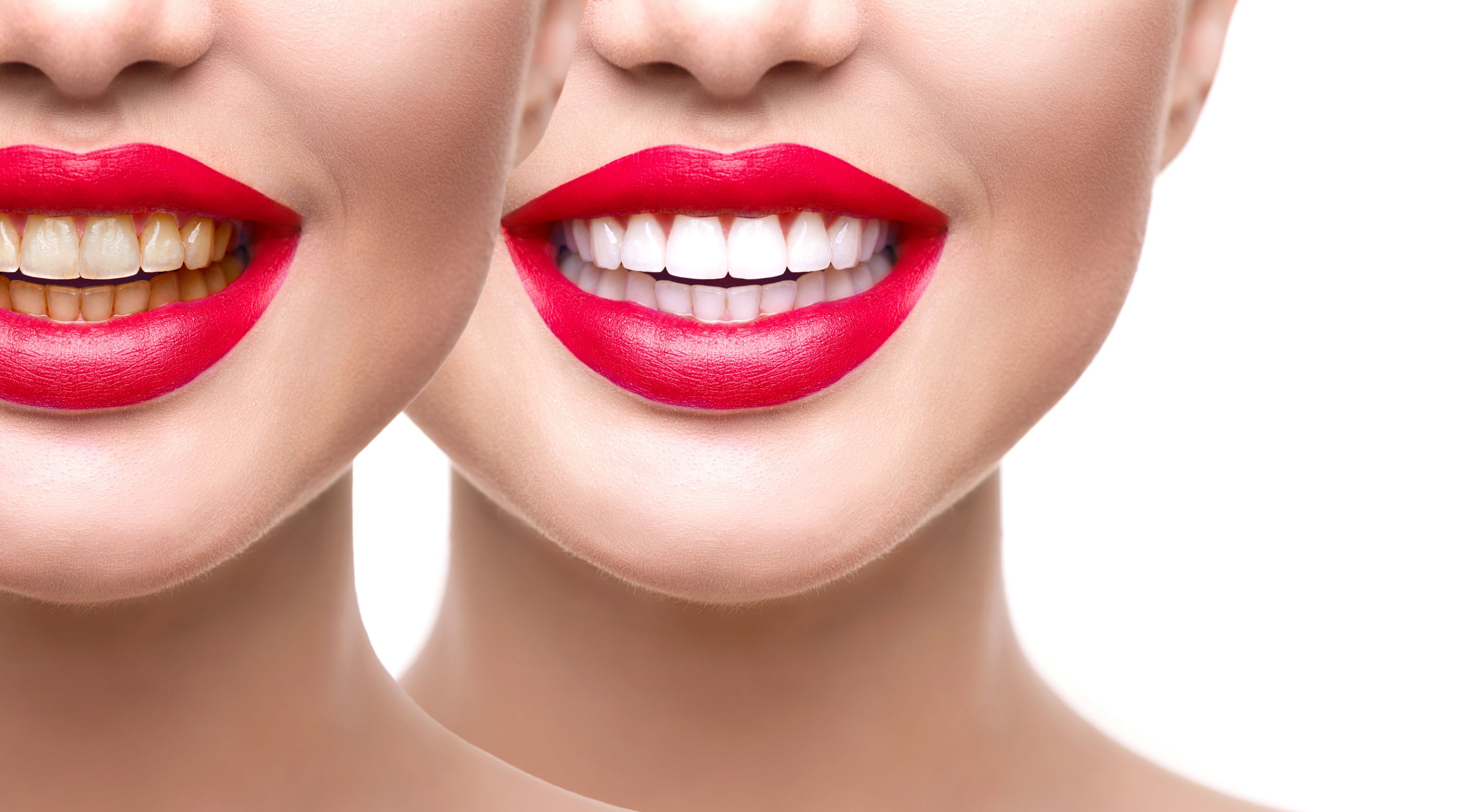 Advantages And Disadvantages Of Teeth Whitening TeethWalls